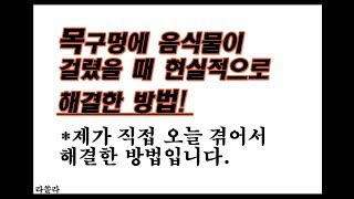 목구멍에 (혹은 식도에) 음식물이 걸렸을 때 현실적으로 쉽게 대처하는 방법! 직접 해봐서 넘어갔습니다.