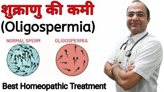 Low sperm count | शुक्राणु की कमी । Oligospermia Homeopathic treatment