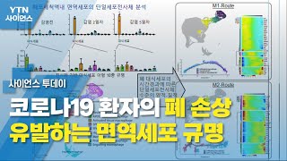 코로나19 환자의 폐 손상 유발하는 면역세포 규명 / YTN 사이언스