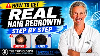 Have Hair Loss? Stop it and REGROW IT: The Ultimate Step-by-Step Guide