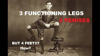 Frank Lentini: The Three-Legged Skater | Untold Stories & Forgotten Memories