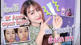 รอยดำจางเร็วมาก!! ลอง BK acne expert bright