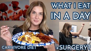 What I Eat + Surgery Consultation