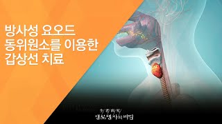 방사성 요오도 동위원소를 이용한 갑상선 기능 기능 치료 - (2016.3.16_575회 방송)_많아도 문제, 적어도 문제 갑상선 호르몬의 두 얼굴