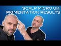 David Hunt - Scalp Micro UK Pigmentation Hair - Craig Bottomley-High