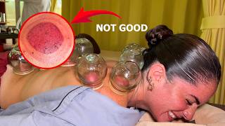 ASMR: I Tried the REAL Chinese FIRE CUPPING with Tuina Massage