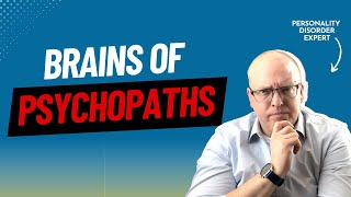 Psychologist Explains 4 Ways Brains of Psychopaths Are Different