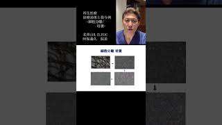 ＜再生医療＞「再生医療　治療成果と投与例」より④細胞分離/培養　YouTubeショート #shorts