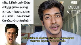 Avulsed teeth can be saved? விபத்தில் பல் கீழே விழுந்தால், அதை காப்பாற்ற என்ன செய்ய வேண்டும் ?