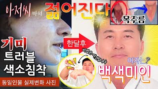 기미 주름살 잡티 칙칙하고 검은피부 색소침착 트러블 다 해결됨!! [ T-12 사용법 ]