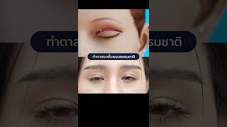 เหมือนเกิดใหม่ #inzclinic #inZeye #ทำตา #รีวิวบิวตี้ #ศัลยกรรมตา #ตาสองชั้น  #ศัลยกรรม