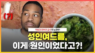 성인여드름 이거 때문이었다고?!😱｜성인여드름 의외의 원인들 총정리! ｜효과 좋다고 하는 여드름약, 맘대로 먹으면 안 되는 이유 - [누나네피부과]