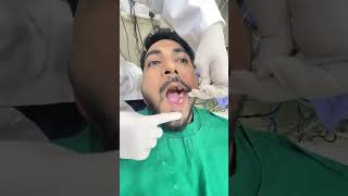 OralHealthManagement #after root canal 🦷 cap is the must💪#oral health#dr. Alka khade