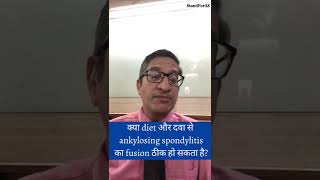 क्या diet, दवा और व्यायाम से ankylosing spondylitis का फ्यूज़न कम हो सकता है?