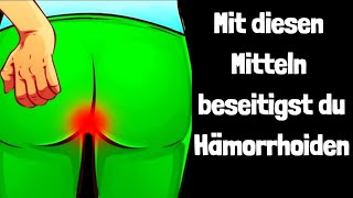 Mit diesen Mitteln beseitigst du Hämorrhoiden!