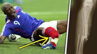10 Horrific Injuries That RUINED The World Cup!