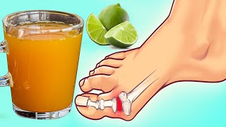 How to Get Rid of Gout Pain Fast, Gout Treatment at Home Naturally!