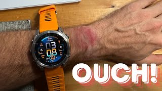 HELP! My New Garmin Fenix 8 Is Beating Me Up