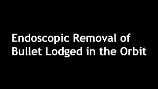 ഭ്രമണപഥത്തിൽ പതിച്ച ബുള്ളറ്റിൻ്റെ എൻഡോസ്കോപ്പിക് നീക്കം | കേസ് അവതരണം
