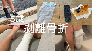 【5歳骨折しました。】ギブスセット購入／お風呂、幼稚園はどうした？／靴は？