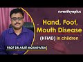 Hand, Foot, Mouth Disease (HFMD): Symptoms and treatment | Dr Arjit Mohapatra