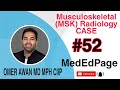 Musculoskeletal (MSK) Radiology CASE #52