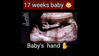 17weekspregnant /babydevelopment /short/shortvideo