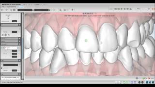 Maestro 3D Ortho Studio 2013   YouTube 720p