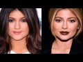 13 of the most drastic celebrity plastic surgeries