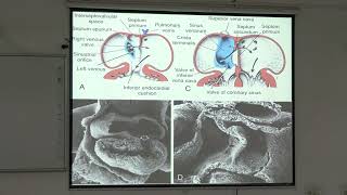 Lecture On MBBS Embryology \u0026 Anatomy: Mastering Cardiovascular \u0026 Respiratory Development