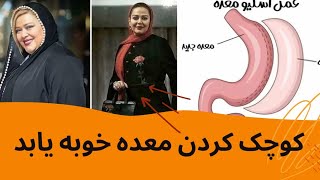 اسلیو معده،مضرات وفوایدودلیل بازگشت وزن بعدازیکسال🙄((قصدعمل داری ببین))