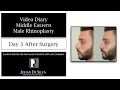 3 Middle Eastern Male Rhinoplasty Video Diary  Day 3 After Surgery