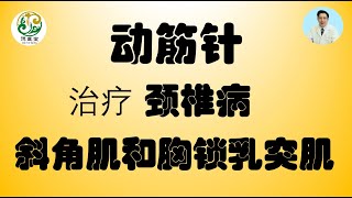 德医堂｜动筋针治疗颈椎病，颈椎病一定要治疗颈椎吗？请看如何松解肌肉来调整颈椎紊乱，斜角肌和胸锁乳突肌治疗颈椎病！