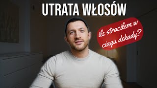 Łysienie androgenowe (utrata włosów). Ile straciłem włosów w ciągu ostatnich (prawie) 10 lat?