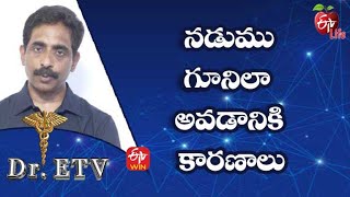 నడుము గూనిలా  అవడానికి కారణాలు | డాక్టర్ ఈటీవీ  | 16th జూలై 2022| ఈటీవీ  లైఫ్