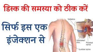 डिस्क की समस्या को ठीक करें | Back Pain relief | Leg Pain Relief | DSCB Injection | Dr Sunil saini