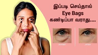 கண்ணுக்கு கீழ் தொங்கும் சதையை குறைப்பது எப்படி? | How To Avoid Eye Bags