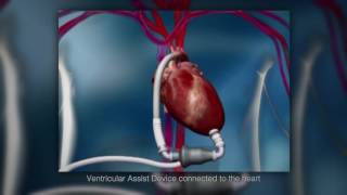 Wellspan Heart & Vascular Physician Video