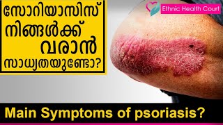 Main Symptoms of psoriasis? | സോറിയാസിസ് നിങ്ങൾക്ക് വരാൻ സാധ്യതയുണ്ടോ?  | Ethnic Health Court