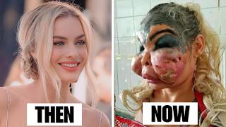 15 Stars Who Completely Ruined Their Faces With Plastic Surgery Disasters | Then and Now Photos 2026