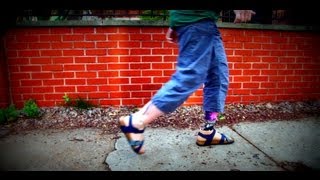 AmputeeOT: Walking in a prosthetic leg (10 days after getting my first leg)