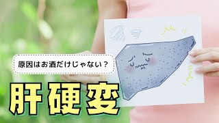 【肝硬変の原因はお酒なの？】-肝硬変の原因や症状を分かりやすく解説！-