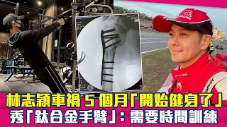 林志穎車禍5個月「開始健身了」　秀「鈦合金手臂」：需要時間訓練