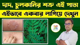 দাদ,চুলকানি নির্মূল হবে এই পাতা লাগিয়ে দেখুন। Best Home Remedy for ringworm, itching, psoriasis.|