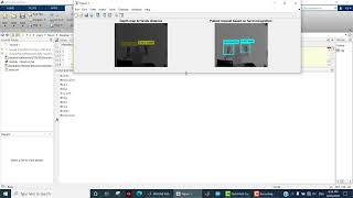 Kinect v2 sensor, Matlab, image processing, computer vision, Hand gesture