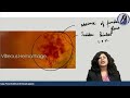 fundus images of retina dr. niha aggarwal