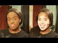 I Won’t Hide My Vitiligo With Makeup | SHAKE MY BEAUTY