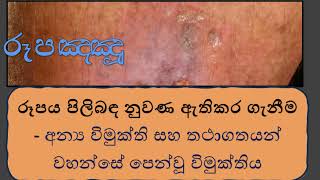 රූපඤ‍්ඤූ  - රූපය පිලිබඳ නුවණ ඇතිකර ගැනීම