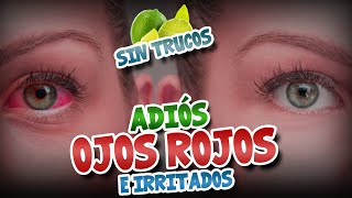 OJOS RESECOS Y LLOROROS QUITA LO ROJO EN INSTANTES !  EL SECRETO DE LOS INFLUENCER/ ROHTO