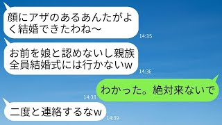 生まれつき顔にアザのある私を見下して、家族全員が結婚式を欠席した母親「お前は娘じゃないw」→数時間後、毒母が式に参加させてほしいと頼んできた理由がwww